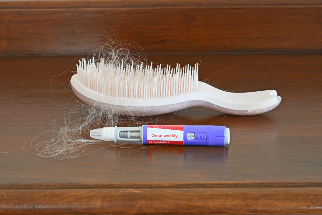 Semaglutide pen next to a hair brush with hair in it to show how semaglutide mght cause hair loss.