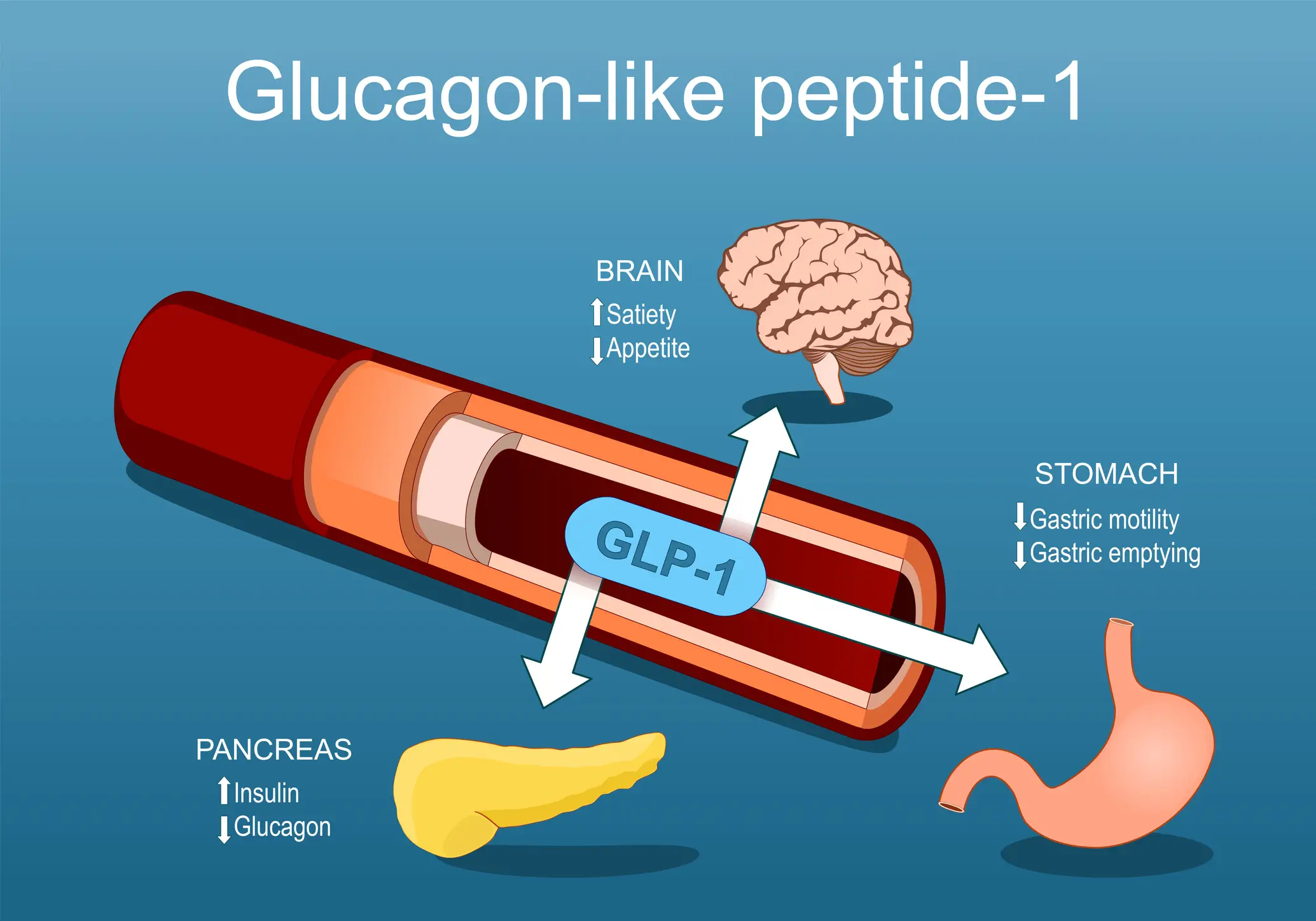 Glucagon-like peptide-1