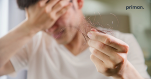 wegovy treatment causes hair loss in men